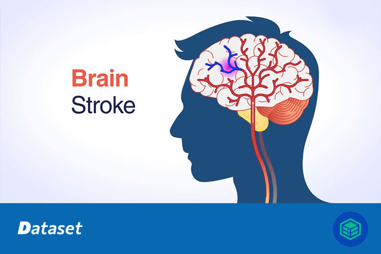 脑血管疾病中风图像分类数据集