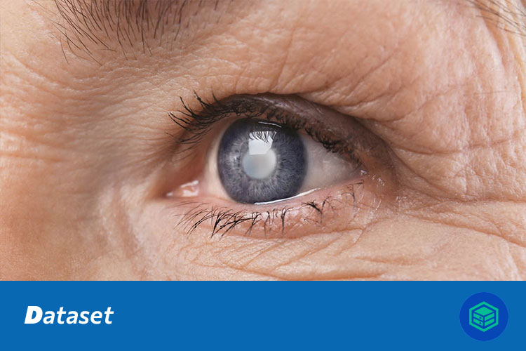 糖尿病视网膜病变图像分类数据集