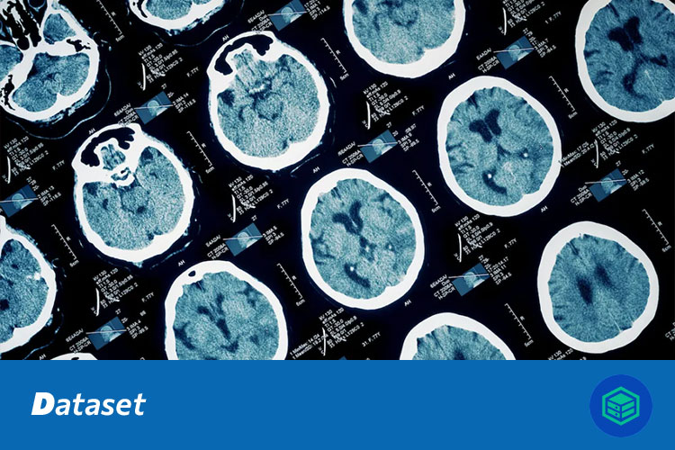 脑肿瘤MRI图像分类数据集
