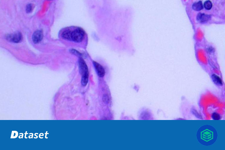肺组织图像分类与肺癌图像分类数据集