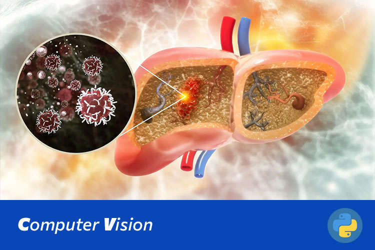 基于Swin Transformer的肝脏肿瘤MRI图像分类与诊断系统