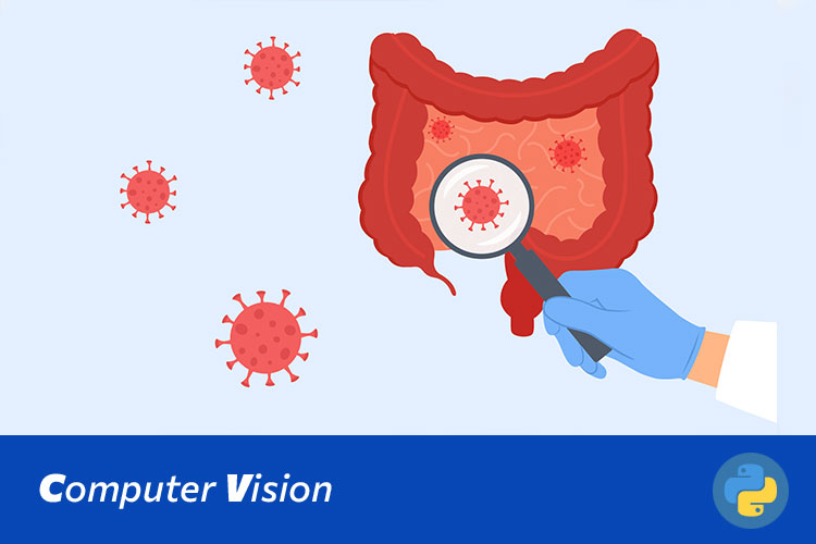 基于Swin Transformer的结肠腺癌与良性结肠组织图像分类与诊断系统