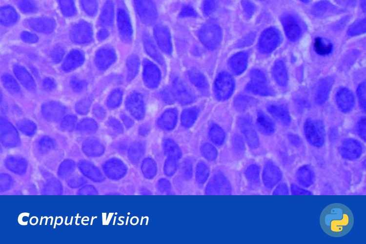 基于Swin Transformer的肺组织图像分类与肺癌早期诊断系统