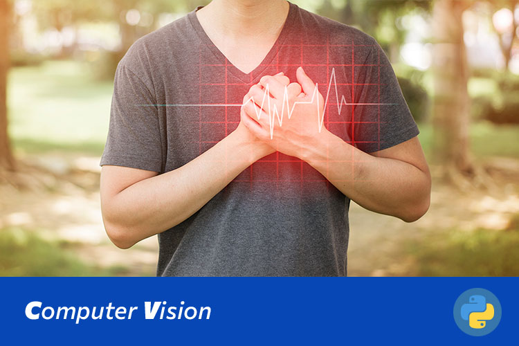 基于Swin Transformer的心电图图像分类与诊断系统