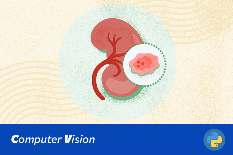 深度学习卷积神经网络的肾脏肿瘤影像诊断系统-ResNet50、VGG16和Swin-Transformer方法的比较研究