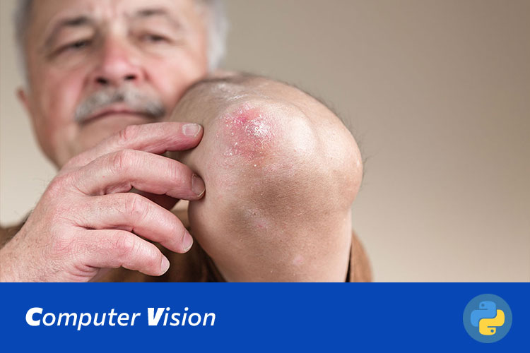 基于Swin Transformer的皮肤病变分类与诊断系统