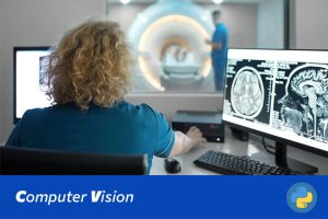 基于深度学习的脑肿瘤自动诊断系统的研究与实现(Web界面+数据集+训练代码)