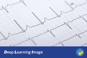 基于Swin Transformer的心电图图像分类与诊断系统