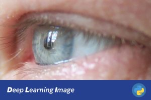 基于深度学习的糖尿病眼底图像分类识别系统（含数据集）