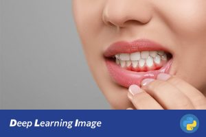 基于深度学习的口腔疾病自主诊断系统设计与实现（UI界面+训练代码+数据集）