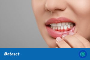 口腔疾病图像分类数据集