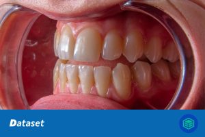 口腔疾病图像检测数据集（YOLO格式）