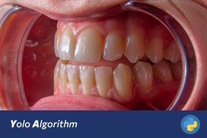 基于深度学习的口腔疾病图像识别系统